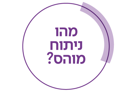 מהו ניתוח מוהס